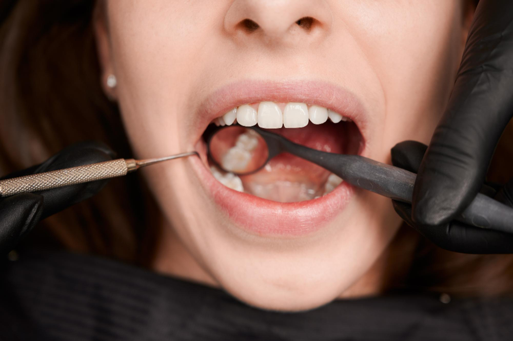 Patient with broken tooth needing same-day repair in Fairfield CA