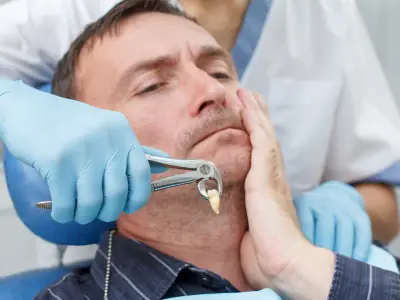 Tooth extraction procedure at Fairfield Dentistry and Implants Fairfield CA